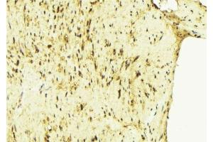 ABIN6275689 at 1/100 staining Mouse muscle tissue by IHC-P. (ZFYVE19 Antikörper  (Internal Region))