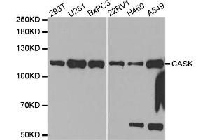 Western blot analysis of extracts of various cell lines, using CASK antibody (ABIN5971336) at 1/1000 dilution. (CASK Antikörper)