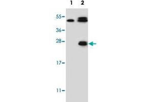 Western blot analysis of KLK6 (arrow) using KLK6 polyclonal antibody . (Kallikrein 6 Antikörper  (Internal Region))