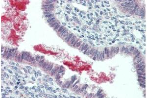 Human Uterus (formalin-fixed, paraffin-embedded) stained with GRN antibody ABIN396952 at 5 ug/ml followed by biotinylated goat anti-rabbit IgG secondary antibody ABIN481713, alkaline phosphatase-streptavidin and chromogen. (Granulin Antikörper  (C-Term))