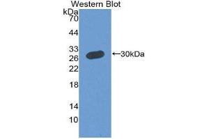 Western Blotting (WB) image for anti-Membrane Protein, Palmitoylated 5 (MAGUK P55 Subfamily Member 5) (MPP5) (AA 455-675) antibody (ABIN2119305) (MPP5 Antikörper  (AA 455-675))