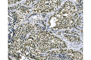 IHC analysis of CSNK2B using anti-CSNK2B antibody (ABIN7599092). (CSNK2B Antikörper  (AA 1-215))