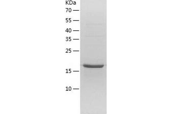 CDK5R1 Protein (AA 1-160) (His tag)