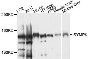 Western blot analysis of extract of various cells, using SYMPK antibody. (Symplekin Antikörper)
