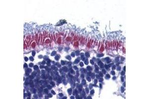 Immunohistochemistry (IHC) image for anti-Apoptosis-Inducing Factor, Mitochondrion-Associated, 1 (AIFM1) (AA 517-531) antibody (ABIN2477305) (AIF Antikörper  (AA 517-531))