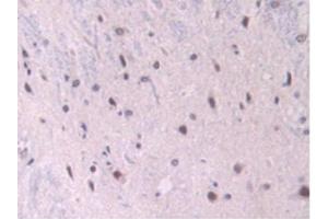 IHC-P analysis of Rat Spinal Cord Tissue, with DAB staining. (Endoglin Antikörper  (AA 26-136))