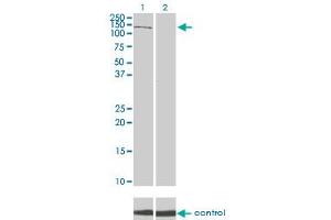 Western blot analysis of PIK3R4 over-expressed 293 cell line, cotransfected with PIK3R4 Validated Chimera RNAi (Lane 2) or non-transfected control (Lane 1).
