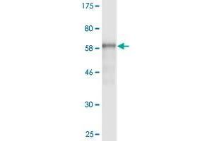 Western Blot detection against Immunogen (62. (AMBP Antikörper  (AA 19-352))