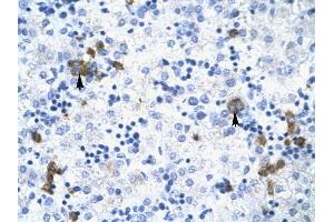 TRIM17 antibody was used for immunohistochemistry at a concentration of 4-8 ug/ml to stain Liver cells (arrows) in Human Liver. (TRIM17 / RNF16 Antikörper  (Middle Region))