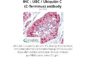 Image no. 2 for anti-Ubiquitin C (UBC) (C-Term) antibody (ABIN2852400) (UBC Antikörper  (C-Term))
