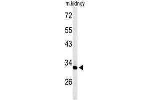 Western blot analysis of TMUB2 Antibody (Center) in mouse kidney tissue lysates (35 µg/lane). (TMUB2 Antikörper  (Middle Region))