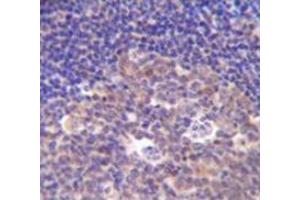 Immunohistochemistry analysis in human tonsil tissue (Formalin-fixed, Paraffin-embedded) using PIK3R5  Antibody  (C-term), followed by peroxidase conjugated secondary antibody and DAB staining. (PIK3R5 Antikörper  (C-Term))