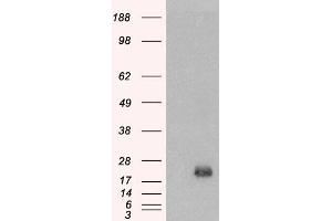 Western Blotting (WB) image for anti-Brain and Acute Leukemia, Cytoplasmic (BAALC) antibody (ABIN5858423) (BAALC Antikörper)