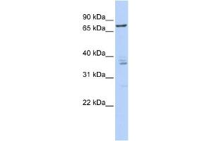 WB Suggested Anti-CSTF3 Antibody Titration:  0.
