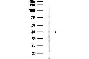 anti-Filaggrin (FLG) (C-Term) antibody