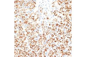 Immunohistochemistry of paraffin-embedded rat ovary using KLHL9 antibody (ABIN6132083, ABIN6142940, ABIN6142941 and ABIN6214299) at dilution of 1:100 (40x lens). (KLHL9 Antikörper  (AA 1-100))
