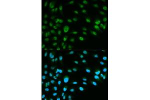 Immunofluorescence analysis of HeLa cell using MCM7 antibody. (MCM7 Antikörper  (AA 360-719))