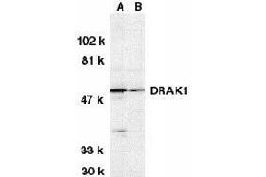 Western blot analysis of DRAK1 in (A) MOLT4 and (B) A431 whole cell lysates with DRAK1 antibody at 1μg/ml.