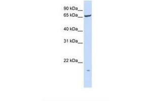 Image no. 1 for anti-Phosphatidylinositol Glycan T (PIGT) (AA 38-87) antibody (ABIN6738312) (PIGT Antikörper  (AA 38-87))