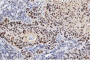 IHC analysis of FEN1 using anti-FEN1 antibody (ABIN7601618). (FEN1 Antikörper  (AA 4-300))