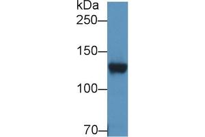 Detection of DPP6 in Rat Cerebrum lysate using Polyclonal Antibody to Dipeptidyl Peptidase 6 (DPP6) (DPP6 Antikörper  (AA 667-865))