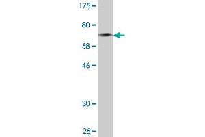 Western Blot detection against Immunogen (74. (GDI1 Antikörper  (AA 1-447))