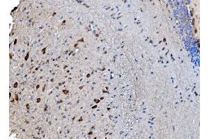 IHC analysis of GABARAP using anti-GABARAP antibody (ABIN7603159). (GABARAP Antikörper  (N-Term))