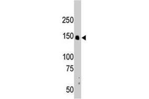 The CRKRS polyclonal antibody  is used in Western blot to detect CRKRS in mouse liver tissue lysate. (CDK12 Antikörper  (N-Term))
