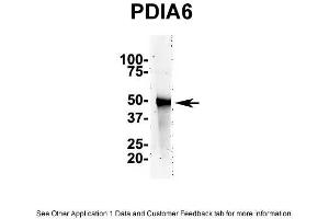 IP Suggested AntiPDIA6 Antibody Positive Control: NT2 CELL/BRAIN TISSUE (PDIA6 Antikörper  (N-Term))