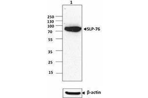 Western Blotting (WB) image for anti-Lymphocyte Cytosolic Protein 2 (SH2 Domain Containing Leukocyte Protein of 76kDa) (LCP2) (AA 216-434) antibody (ABIN2666114)