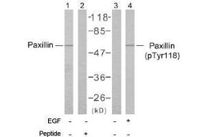 Image no. 2 for anti-Paxillin (PXN) (Tyr118) antibody (ABIN197278) (Paxillin Antikörper  (Tyr118))