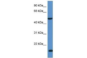 Western Blot showing INPP5K antibody used at a concentration of 1 ug/ml against Fetal Liver Lysate (INPP5K Antikörper  (C-Term))