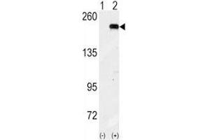 Western blot analysis of GCN2 antibody and 293 cell lysate (2 ug/lane) either nontransfected (Lane 1) or transiently transfected with the GCN2 gene (2). (GCN2 Antikörper  (AA 1-30))