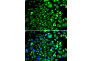 Immunofluorescence analysis of A549 cells using OSGEP antibody (ABIN5975559). (OSGEP Antikörper)