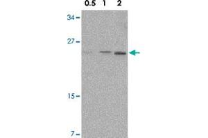 Western blot analysis of NKIRAS1 in Raw 264. (NKIRAS1 Antikörper  (C-Term))