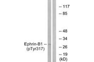 Western blot analysis of extracts from mouse brain, using EFNB1 (Phospho-Tyr317) Antibody. (Ephrin B1 Antikörper  (pTyr317))