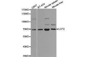 Western blot analysis of extracts of various cell lines, using LCP2 antibody. (LCP2 Antikörper  (AA 284-533))