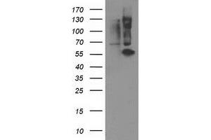 Western Blotting (WB) image for anti-Protein Phosphatase, Mg2+/Mn2+ Dependent, 1B (PPM1B) antibody (ABIN1500372) (PPM1B Antikörper)