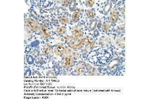 Immunohistochemistry (IHC) image for anti-TAF6 RNA Polymerase II, TATA Box Binding Protein (TBP)-Associated Factor, 80kDa (TAF6) (N-Term) antibody (ABIN2775955)
