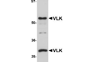 Western Blotting (WB) image for anti-Protein Kinase Domain Containing, Cytoplasmic Homolog (Mouse) (PKDCC) (Middle Region) antibody (ABIN1031161) (PKDCC Antikörper  (Middle Region))