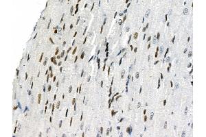 Phospho-Smad5 (Ser463/Ser465) Antibody at 1/100 staining Rat heart tissue by IHC-P. (SMAD5 Antikörper  (pSer463, pSer465))