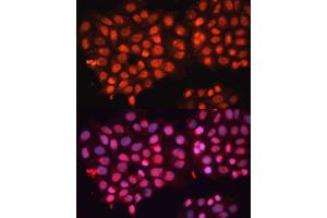 Immunofluorescence analysis of HeLa cells using  Polyclonal Antibody (ABIN3016382, ABIN3016383, ABIN3016384 and ABIN6219737) at dilution of 1:100 (40x lens). (ABCB8 Antikörper  (AA 469-718))