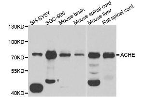 Western blot analysis of extracts of various cell lines, using ACHE antibody. (Acetylcholinesterase Antikörper  (AA 398-617))