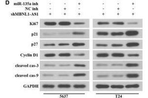 MBNL1-AS1 regulated the proliferation and apoptosis of BC cells via miR-135a/PHLPP2/FOXO1 axis. (Ki-67 Antikörper  (AA 700-800))