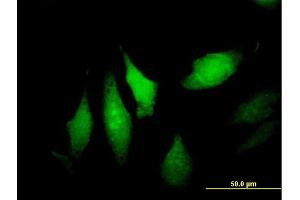Immunofluorescence of purified MaxPab antibody to DNALI1 on HeLa cell. (DNALI1 Antikörper  (AA 1-258))