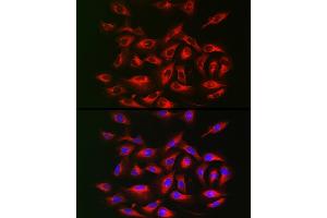 Immunofluorescence analysis of U2OS cells using IRS2 Rabbit pAb (ABIN6128094, ABIN6142544, ABIN6142545 and ABIN6223949) at dilution of 1:25 (40x lens).