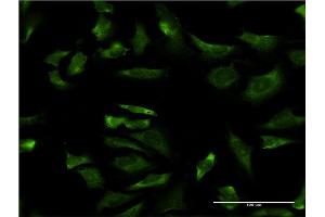 Immunofluorescence of monoclonal antibody to LOC402176 on HeLa cell. (RPL21P44 Antikörper  (AA 1-136))