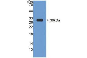 Western blot analysis of recombinant Rat HMGCR. (HMGCR Antikörper  (AA 638-887))