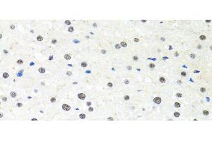 Immunohistochemistry of paraffin-embedded Rat liver using PPP4C Polyclonal Antibody at dilution of 1:100 (40x lens). (PPP4C Antikörper)