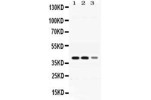 Western blot analysis of ADH4 expression in rat liver extract ( Lane 1), mouse liver extract ( Lane 2) and HEPG2 whole cell lysates ( Lane 3).